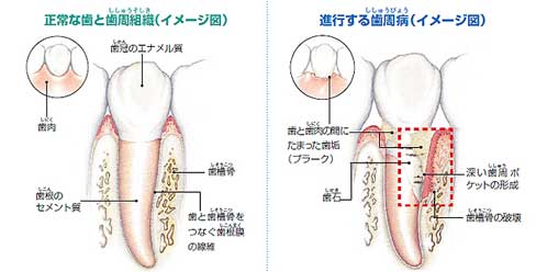 歯周組織の模式図